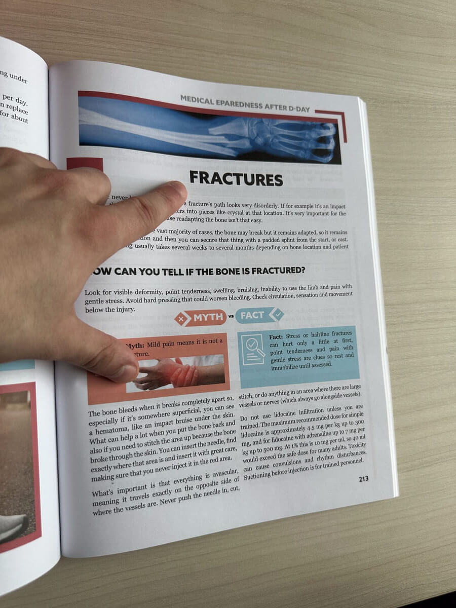 A full-color page on fractures from the current edition of Survival MD