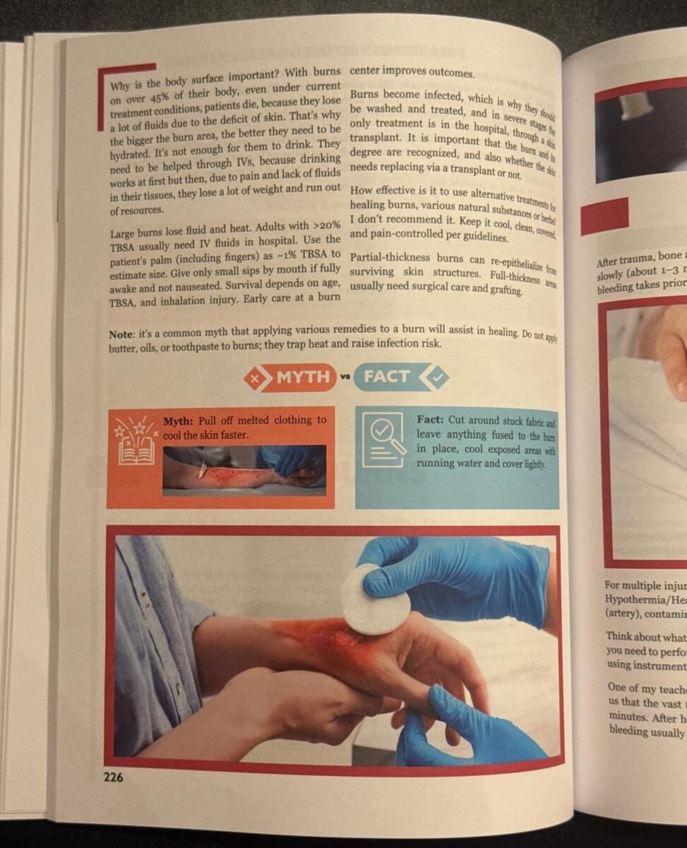 Survival MD burns page with a Myth vs Fact box about melted clothing