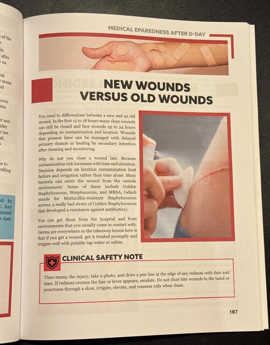 Survival MD New Wounds Versus Old Wounds section